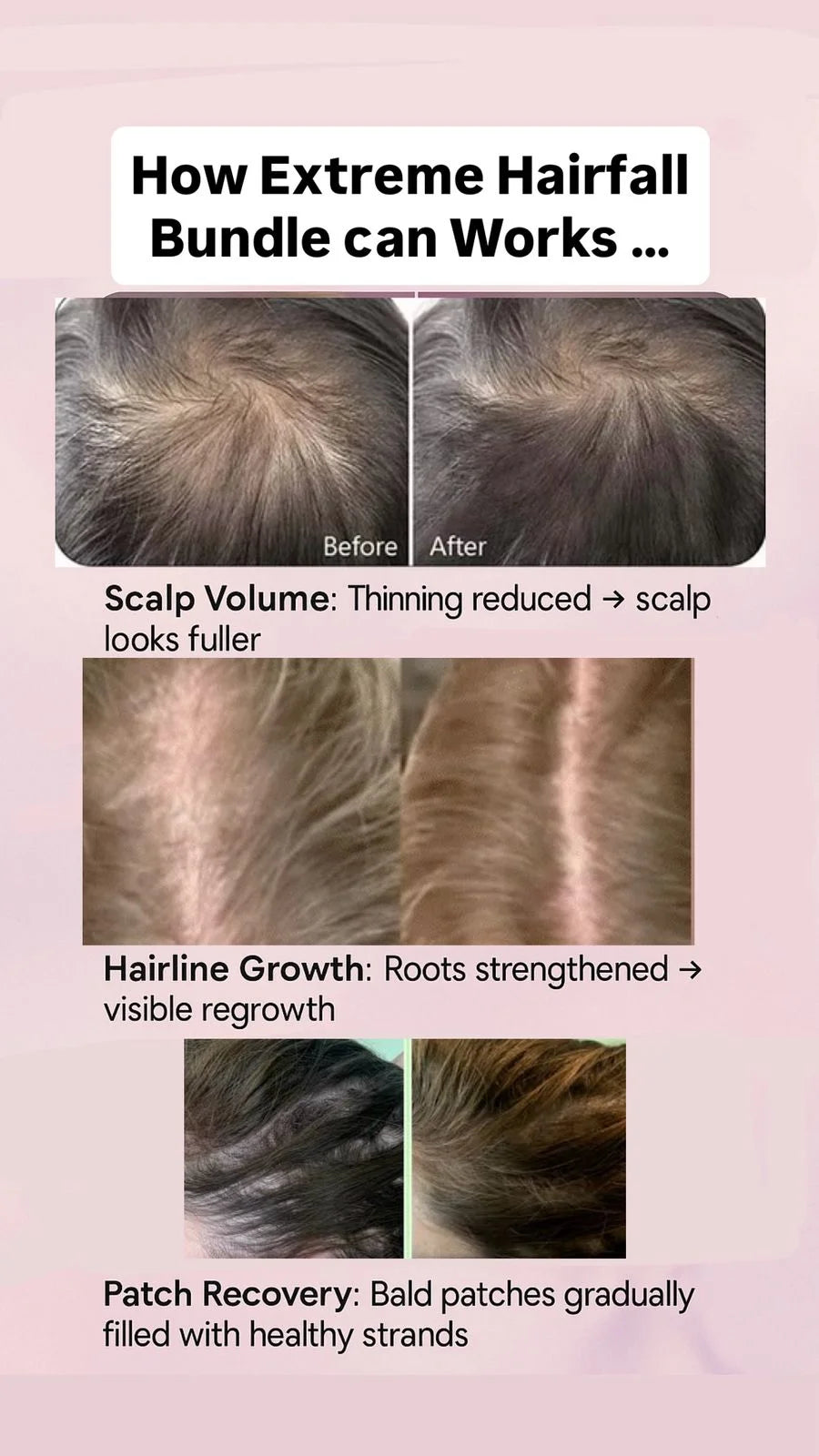 3 in 1 - Extreme Hairfall