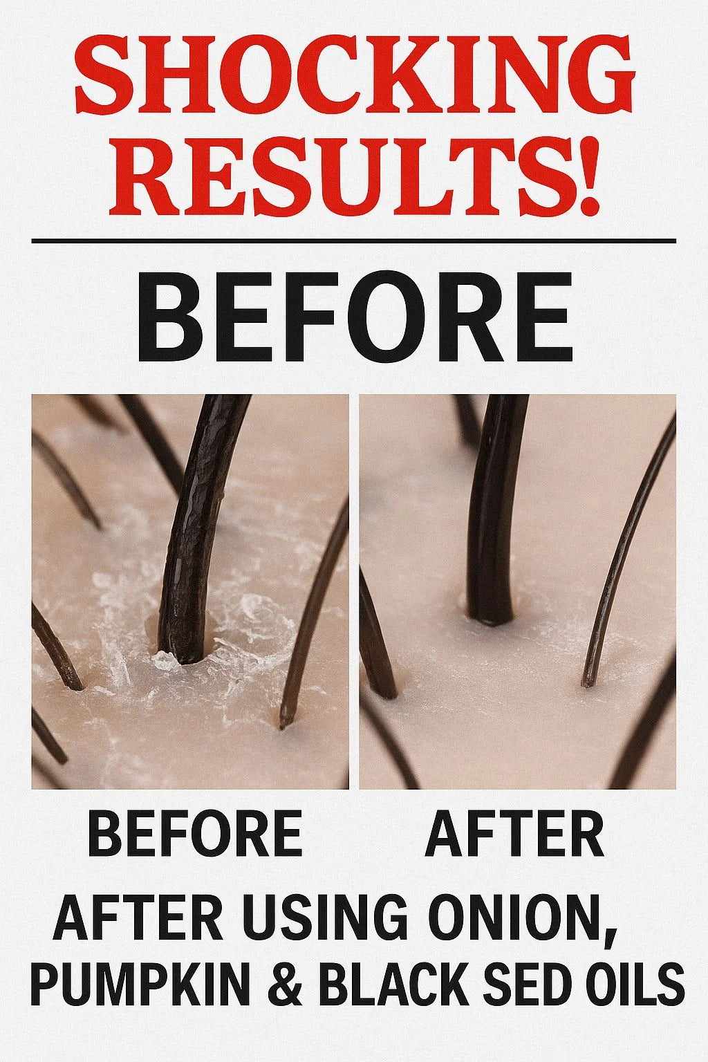 3 in 1 - Extreme Hairfall